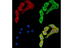 ABIN7096533 and ABIN7100597 staining Hela cells by IF/ICC.