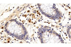 Immunohistochemistry (IHC) image for anti-Interleukin 7 Receptor (IL7R) (AA 173-260) antibody (ABIN7434320)