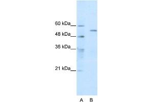 WB Suggested Anti-TRIM35 Antibody Titration:  0. (TRIM35 Antikörper  (C-Term))