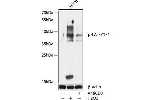 Western blot analysis of extracts of Jurkat cells, using Phospho-LAT-Y171 antibody (ABIN7268273) at 1:1000 dilution. (LAT Antikörper  (pTyr171))
