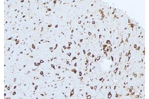 ABIN6276418 at 1/100 staining Mouse brain tissue by IHC-P. (Caspase 1 Antikörper  (C-Term))