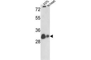 Western blot analysis of VDAC1 Antibody (N-term) in A375 cell line and mouse heart tissue lysates (35ug/lane).