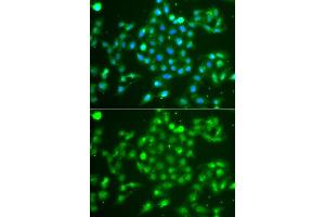 Immunofluorescence analysis of A549 cell using UCHL5 antibody. (UCHL5 Antikörper)