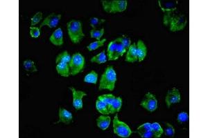 Immunofluorescent analysis of MCF-7 cells using ABIN7174192 at dilution of 1:100 and Alexa Fluor 488-congugated AffiniPure Goat Anti-Rabbit IgG(H+L) (LSM4 Antikörper  (AA 1-139))