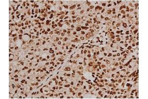 Immunohistochemistry (IHC) image for anti-PTK2 Protein tyrosine Kinase 2 (PTK2) (pTyr397) antibody (ABIN6256730)