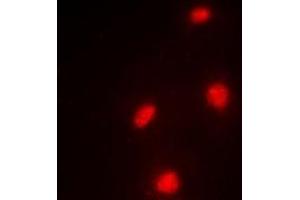 Immunofluorescent analysis of MTF-2 staining in A549 cells. (MTF2 Antikörper)