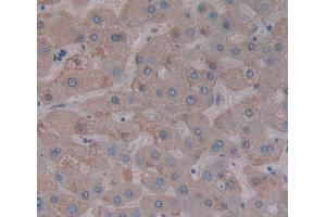 Used in DAB staining on fromalin fixed paraffin- embedded liver tissue (PPFIA1 Antikörper  (AA 1-250))