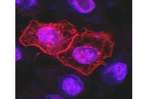 Immunocytochemistry (ICC) image for anti-Tumor Necrosis Factor Receptor Superfamily, Member 10a (TNFRSF10A) antibody (ABIN2749053)