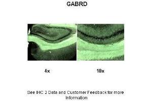 Sample Type :  Rat brain section  Primary Antibody Dilution :  1:1000  Secondary Antibody :  Anti-rabbit-biotin, streptavidin-diaminobenzidine  Secondary Antibody Dilution :  1:500  Gene Name :  GABRD  Submitted by :  Dr. (GABRD Antikörper  (N-Term))