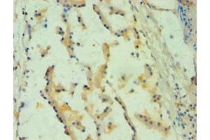 Immunohistochemistry of paraffin-embedded human prostate tissue using ABIN7157738 at dilution of 1:100 (SPINT1 Antikörper  (AA 250-529))