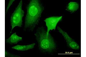 Immunofluorescence of monoclonal antibody to YY1AP1 on HeLa cell. (YY1AP1 Antikörper  (AA 1-739))
