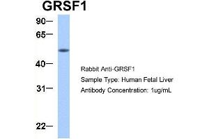 Host:  Rabbit  Target Name:  GRSF1  Sample Type:  Human Fetal Liver  Antibody Dilution:  1. (GRSF1 Antikörper  (Middle Region))