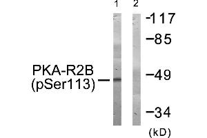 Western blot analysis of extracts from COS-7 cells, treated with A (125 ng/mL, 30 mins), using PKA-R2β (Phospho-Ser113) antibody. (PRKAR2B Antikörper  (pSer113))