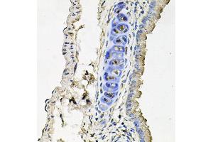 Immunohistochemistry of paraffin-embedded mouse lung using SLC39A4 antibody (ABIN5971796) at dilution of 1/100 (40x lens). (SLC39A4 Antikörper)