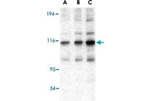 Western blot analysis of TRAF2 in mouse liver tissue lysate with TRAF2 polyclonal antibody  at (A) 0. (TRAF2 Antikörper  (C-Term))