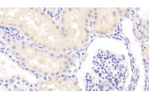 Immunohistochemistry (IHC) image for anti-Proteasome (Prosome, Macropain) 26S Subunit, Non-ATPase, 6 (PSMD6) (AA 1-389) antibody (ABIN7443659)