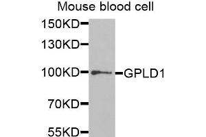 Western blot analysis of extracts of mouse blood cells, using GPLD1 antibody. (GPLD1 Antikörper)