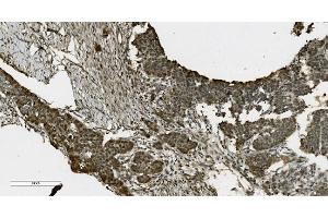 IHC analysis of PARP using anti-PARP antibody (ABIN7602276).