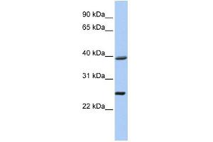 WB Suggested Anti-C12orf42 Antibody Titration: 0. (C12orf42 Antikörper  (N-Term))