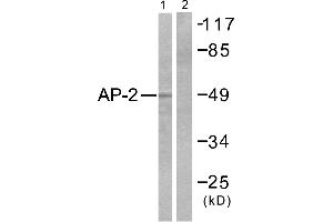 Western blot analysis of extracts from COLO205 cells, using AP-2 antibody. (TFAP2A Antikörper)