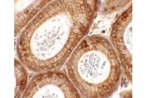 Immunohistochemistry of SPATA6 in mouse testis tissue with SPATA6 antibody at 2. (SPATA6 Antikörper  (C-Term))