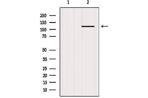 Western blot analysis of extracts from Mouse lung, using PKD1/PKC μ Antibody.
