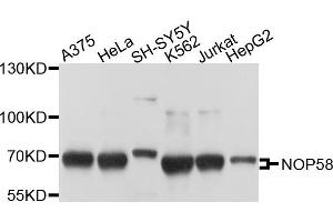 Western blot analysis of extracts of various cells, using NOP58 antibody. (NOP58 Antikörper)