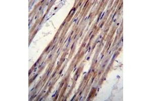 Immunohistochemistry analysis in formalin fixed and paraffin embedded human heart tissue reacted with KCNJ8 Antibody (N-term) followed which was peroxidase conjugated to the secondary antibody and followed by DAB staining.
