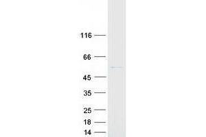 CYP2R1 Protein (Myc-DYKDDDDK Tag)