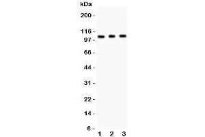 Western blot testing of GRIK1 antibody and Lane 1:  mouse brain;  2: mouse brain;  3: human SHG-44 (glioma) lysate. (GRIK1 Antikörper  (AA 271-450))