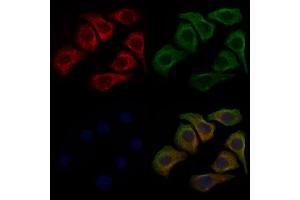 ABIN6266049 and ABIN6278958 staining Hela cells by IF/ICC.