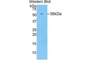 Western blot analysis of the recombinant protein. (LMYC Antikörper  (AA 186-439))