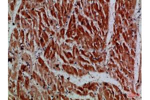 Immunohistochemical analysis of paraffin-embedded Human-heart, antibody was diluted at 1:100 (MYH6 Antikörper)
