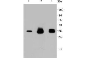 Lane 1: HeLa Cell lysates, Lane 2: PC12 Cell lysates, Lane 3: SH-SY5Y Cell lysates,probed with Cyclin D1 (2H4) Monoclonal Antibody  at 1:1000 overnight at 4˚C. (Cyclin D1 Antikörper)