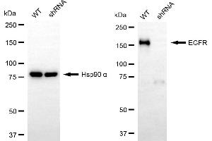 Western blotting analysis using EGFR antibody (ABIN7798460).