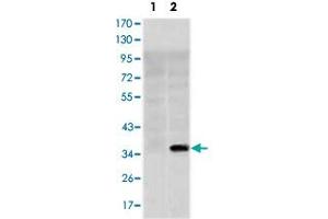 Western blot analysis using SLC22A1 monoclonal antobody, clone 2C5  against HEK293 (1) and SLC22A1-hIgGFc transfected HEK293 (2) cell lysate. (SLC22A1 Antikörper)