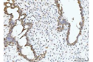 IHC analysis of BCKDK using anti-BCKDK antibody (ABIN7601470). (BCKDK Antikörper  (AA 36-316))