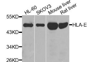 Western blot analysis of extracts of various cell lines, using HLA-E antibody (ABIN5974852) at 1/1000 dilution. (HLA-E Antikörper)