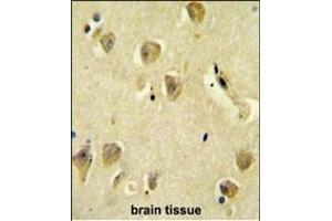 Immunohistochemistry (Paraffin-embedded Sections) (IHC (p)) image for anti-Protein Phosphatase 1, Regulatory (Inhibitor) Subunit 14C (PPP1R14C) (AA 126-155), (C-Term) antibody (ABIN654110)
