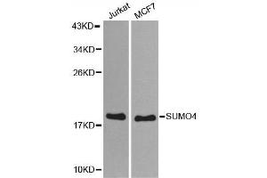 Western blot analysis of extracts of various cell lines, using SUMO4 antibody. (SUMO4 Antikörper)