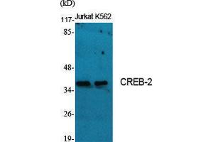 Western Blotting (WB) image for anti-Activating Transcription Factor 4 (Tax-Responsive Enhancer Element B67) (ATF4) (Ser159) antibody (ABIN3174554) (ATF4 Antikörper  (Ser159))