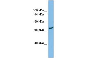Host:  Rabbit  Target Name:  SLC8A1  Sample Type:  ACHN Whole Cell lysates  Antibody Dilution:  1. (SLC8A1 Antikörper  (N-Term))