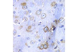 Immunohistochemistry of paraffin-embedded mouse brain using RPS3A antibody at dilution of 1:100 (x40 lens).