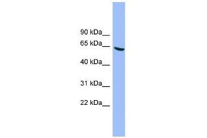 WB Suggested Anti-DYRK3 Antibody Titration: 0. (DYRK3 Antikörper  (N-Term))