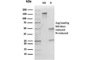 SDS-PAGE Analysis Purified p27 Mouse Monoclonal Antibody (KIP1/769). (CDKN1B Antikörper)