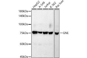 Western blot analysis of extracts of various cell lines, using GNE antibody (ABIN7267398) at 1:1000 dilution. (GNE Antikörper)