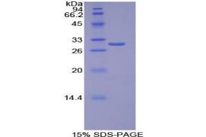 SDS-PAGE analysis of Human Torsin 1B Protein. (TOR1B Protein)