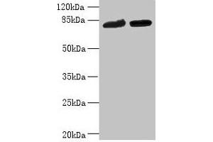 Western blot All lanes: DDHD2 antibody at 10 μg/mL Lane 1: K562 whole cell lysate Lane 2: U251 whole cell lysate Secondary Goat polyclonal to rabbit IgG at 1/10000 dilution Predicted band size: 82, 38 kDa Observed band size: 82 kDa (DDHD2 Antikörper  (AA 361-650))