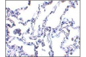 AP30640PU-N p53R2 antibody staining of Human lung tissue by Immunohistochemistry at 1 μg/ml. (RRM2B Antikörper  (N-Term))
