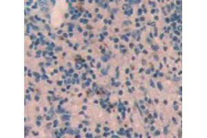 Used in DAB staining on fromalin fixed paraffin- embedded Kidney tissue (STING/TMEM173 Antikörper  (AA 160-371))